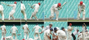 Phil Hughes Injury Pics